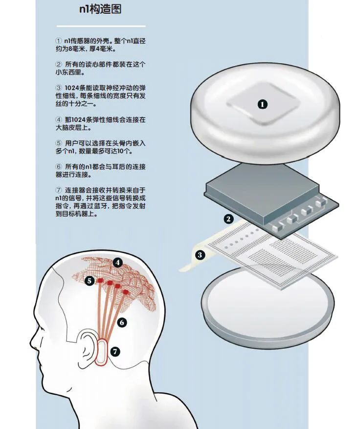 大脑|你会在大脑当中植入高性能的芯片吗？
