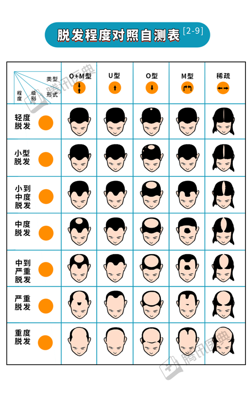 脱发|被脱发难倒的2.5亿中国人，大部分其实还有救！3招教你不再秃