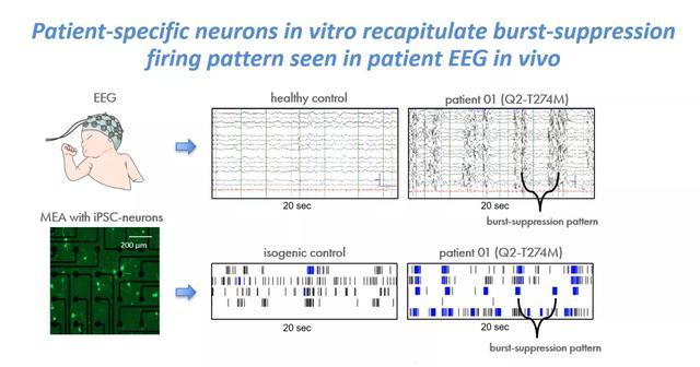 脑科学|【文献汇编】多孔微电极阵列在脑科学研究中的应用（聚焦癫痫