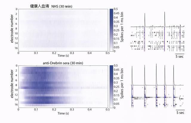 脑科学|【文献汇编】多孔微电极阵列在脑科学研究中的应用（聚焦癫痫