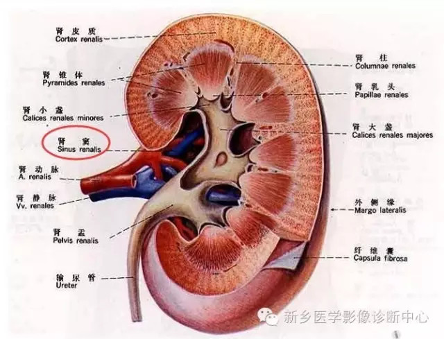 9种肾窦病变,看看看完能掌握几个