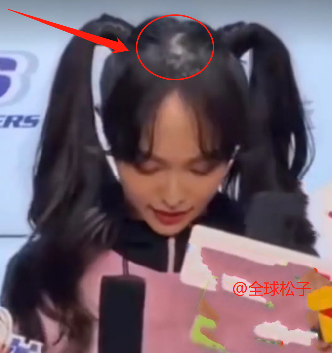唐嫣|唐嫣精修图少女感满满，生图却“翻车”：脑门大还有点秃