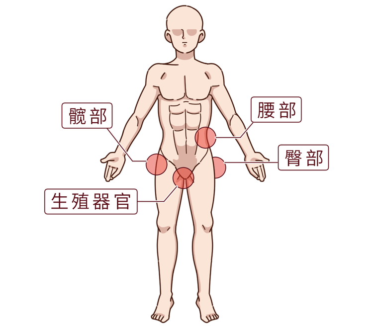 浙江一男子腰痛半月 一查竟是癌症晚期 这症状很多人忽视 腾讯新闻