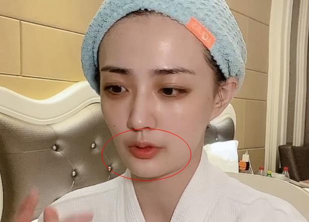 徐璐晒13000块美容仪,素颜裹毛巾接地气,嘴角"黑乎乎"引热议
