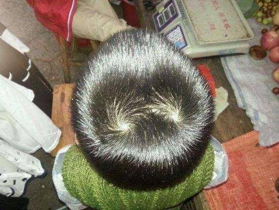 头上有两个旋的孩子比一个旋的孩子更聪明吗?