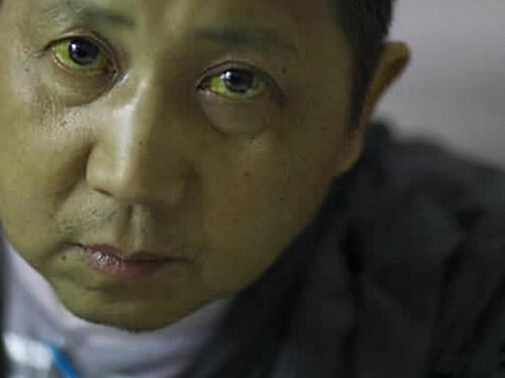 肝癌都是拖出来的,早期"脸上"出现四种迹象,肝已病变