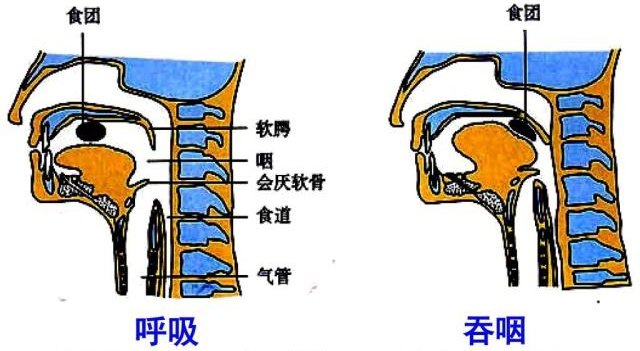 魚刺卡喉喝醋能行嗎其他異物卡喉要怎麼做