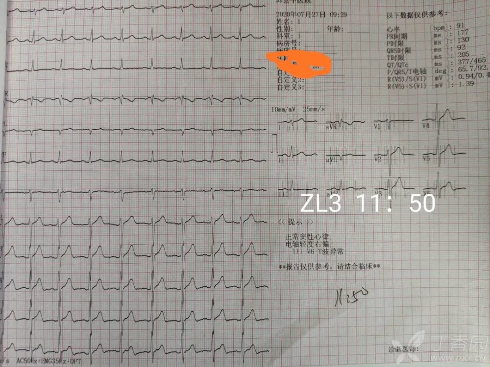 胸痛|胸痛只想到心梗？千万别忘了还有个它！