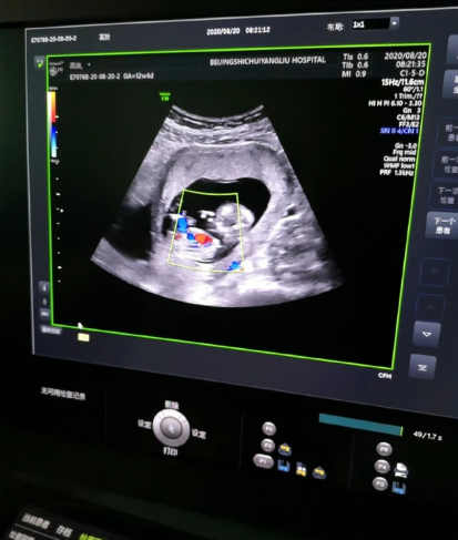 王梓芠|《如懿传》女演员王梓芠被曝插足当小三，当事人回应：是留宿关系