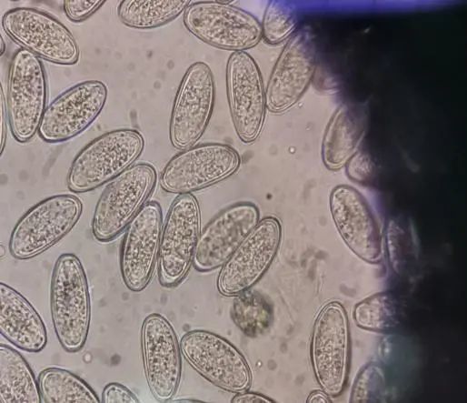 蛲虫卵 显微镜图片