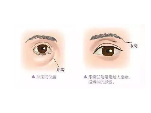 人体自带8个"养生窝",坚持按揉百病除,让你不浪费钱买保健品