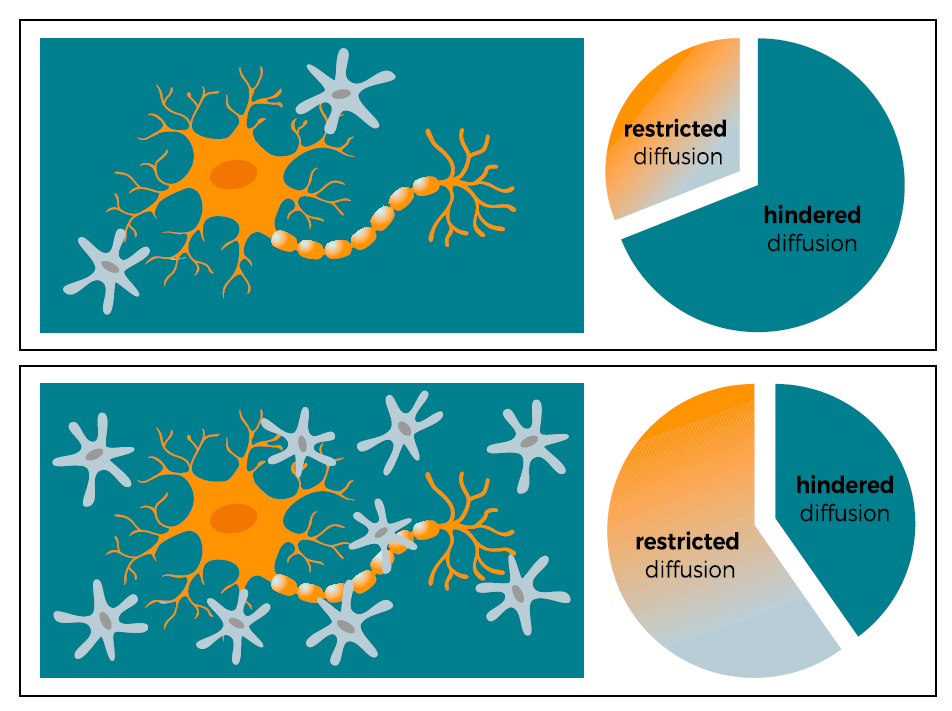 脑成像|PNAS：神经炎症破坏奖赏环路，脑成像可以预测儿童体重的增加
