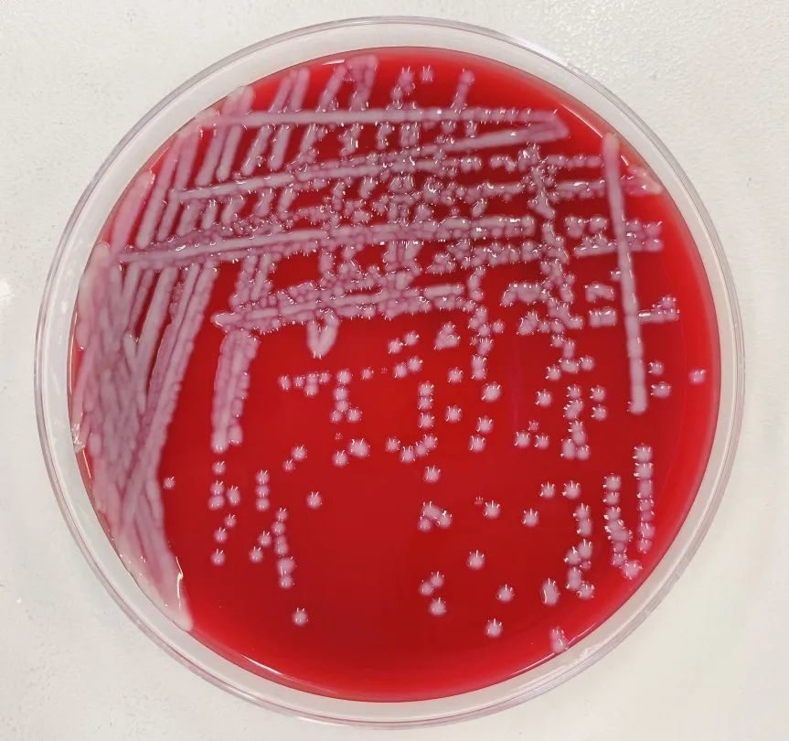肺炎克雷伯菌 腾讯网