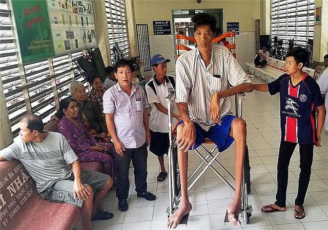 57米,35岁逝世 尽管曾金莲的身高达到了2.