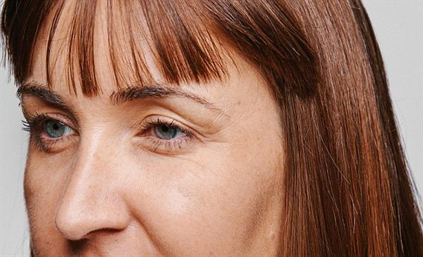 一条皱纹显老5岁脸部皱纹有哪些隐藏小秘密一起看一下吧郑明明