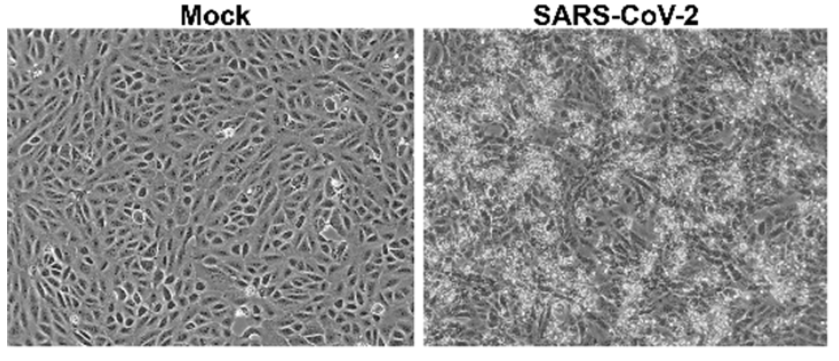 刺突蛋白|Structure｜中国学者揭示灭活SARS-CoV-2的刺突蛋白结构