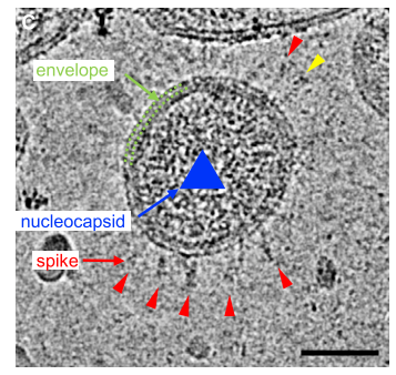 刺突蛋白|Structure｜中国学者揭示灭活SARS-CoV-2的刺突蛋白结构