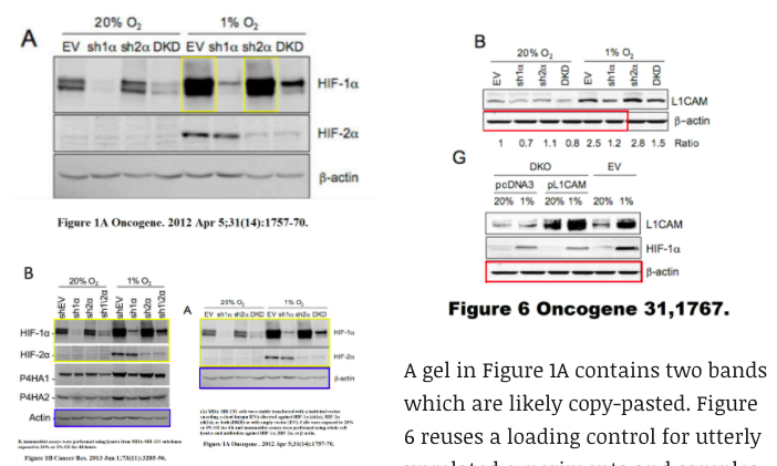 格雷格·塞门扎|2019诺贝尔奖得主塞门扎翻车！论文涉嫌造假，网友：P图才是科研利器？