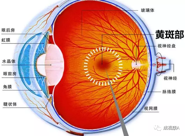 黄斑变性|眼睛发生黄斑病变，离不开这5个原因