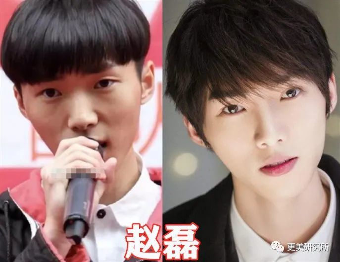 吉娜|吉娜怀孕了，技术流分析她的孩子会遗传整形前吗？