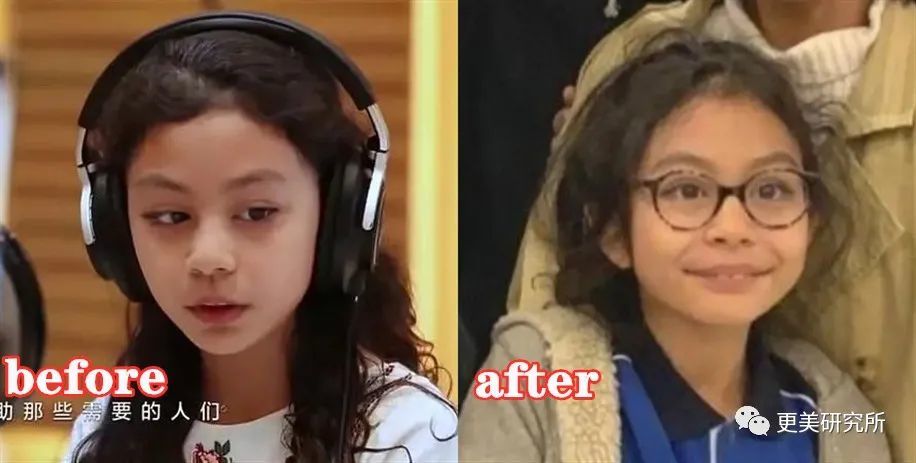 吉娜|吉娜怀孕了，技术流分析她的孩子会遗传整形前吗？