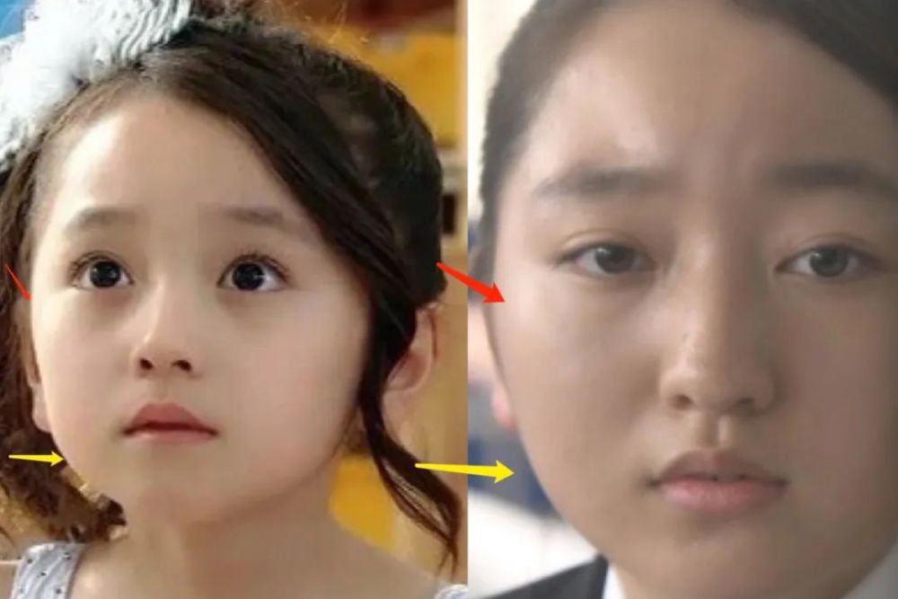 吉娜|吉娜怀孕了，技术流分析她的孩子会遗传整形前吗？