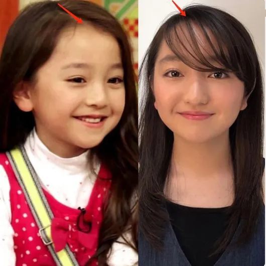 吉娜|吉娜怀孕了，技术流分析她的孩子会遗传整形前吗？