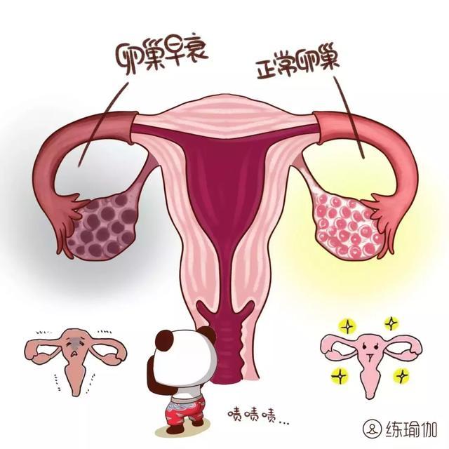 每天坚持6个动作,清理子宫垃圾