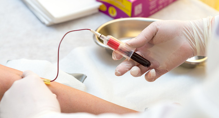 心电图|天冷了！心脑血管疾病的人，做这些复查，确保我们平平安安！