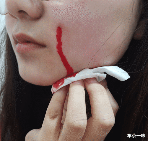 "女朋友脸上莫名的流血,"看到网友的评论,吓的我赶紧成为单身哈哈哈哈