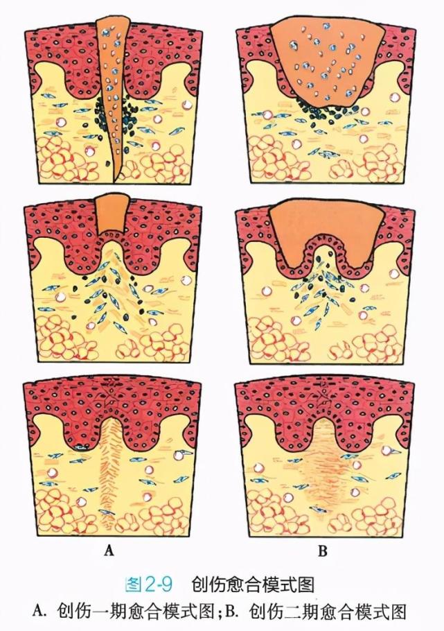 乳腺癌术后n年伤口还痛 就一定是复发了吗 乳腺癌 维生素c 糖尿病