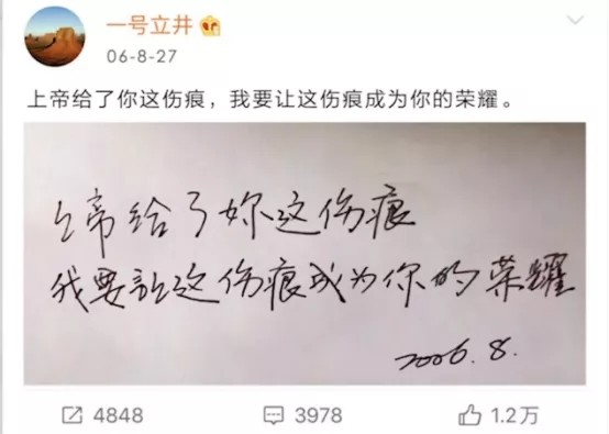 李亚鹏|李亚鹏罕见分享女儿小时候唇裂手术后照片，李嫣嘴唇上还贴着胶布