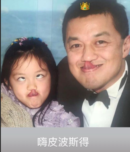 李亚鹏|李亚鹏罕见分享女儿小时候唇裂手术后照片，李嫣嘴唇上还贴着胶布