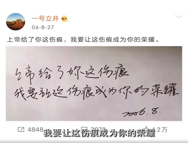 李亚鹏|李亚鹏公开李嫣婴儿时期照片，刚做完第一次手术嘴唇还贴着胶布