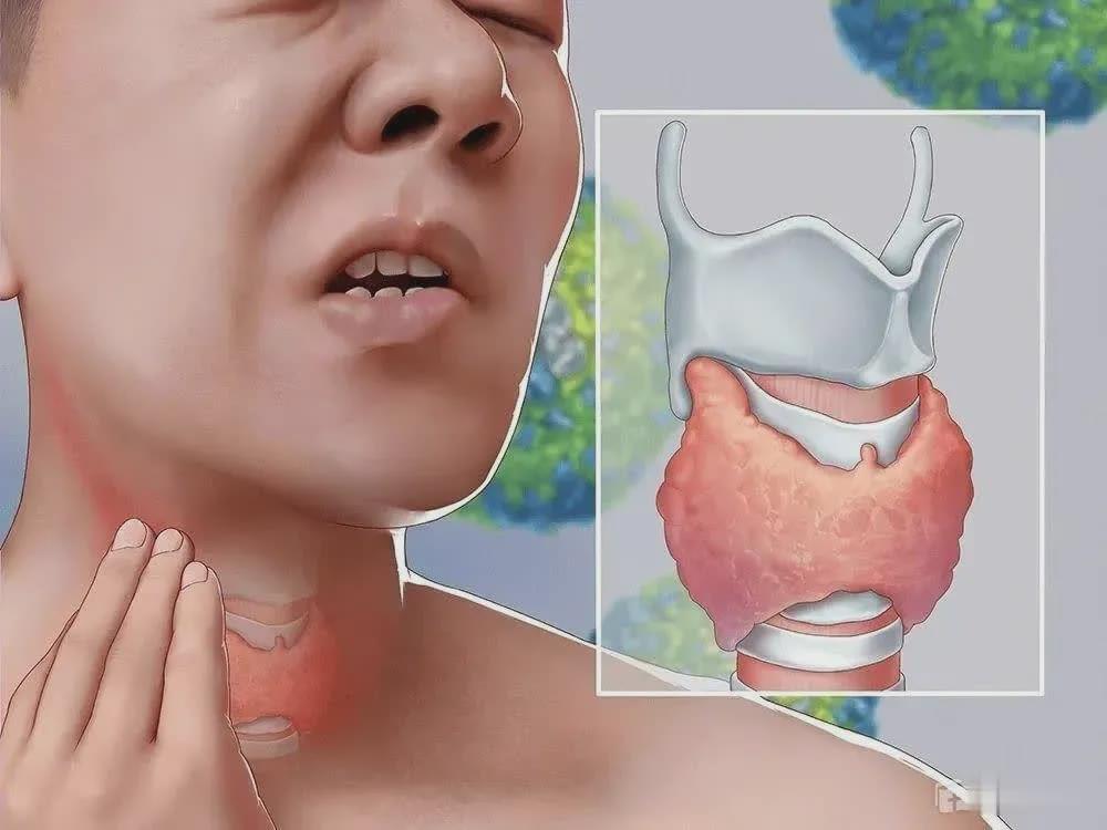 6姐弟3人同患一种癌长这种喉结要当心特别是女性