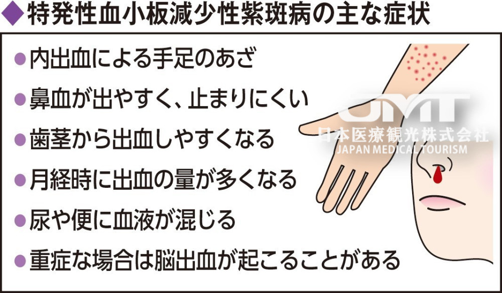 随着治疗进步 根治特发性血小板减少性紫斑病也将成为可能 腾讯新闻
