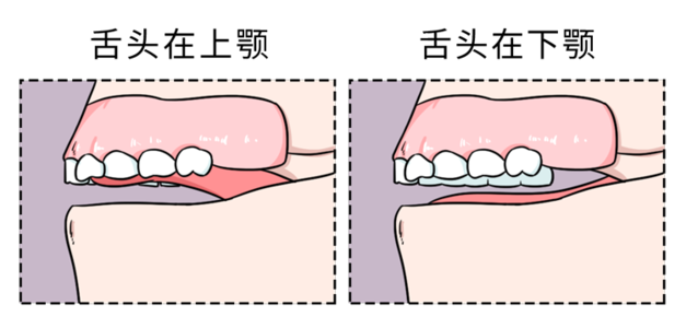 正常人一般用鼻子呼吸 低头时嘴巴是紧闭的 平时舌头会顶在上颚 如果