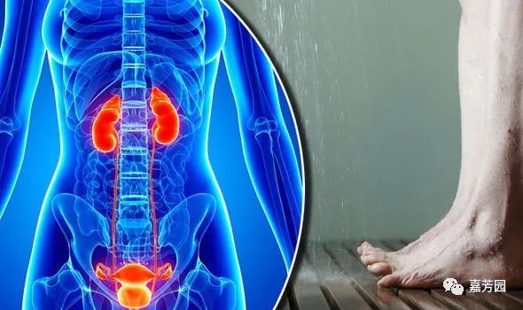 芳香疗法知识学习 膀胱炎的反思