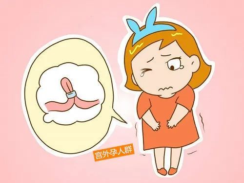 1,宫外孕后的症状有以下几个方面1停经,早孕检查阳性,但是正常检查时