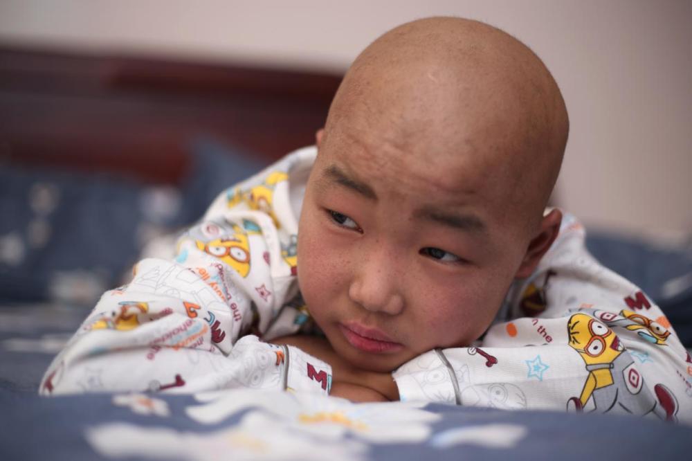 结婚16年后妻子意外怀孕,孩子4岁出现异常,结果让他痛心