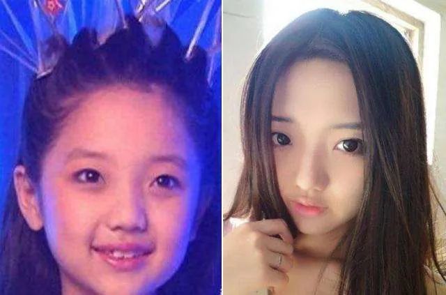 童星|“红过”，是童星逃不过的心酸