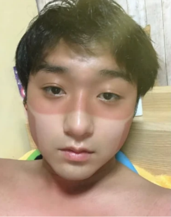 "这下好了,以后不用戴口罩了…"哈哈这兄弟属实倒霉!