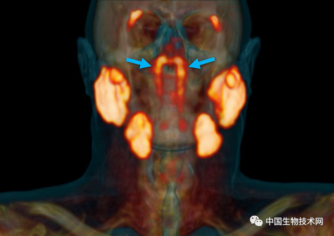 鼻咽|意外发现！鼻咽中一个被忽略几个世纪的“神秘组织”