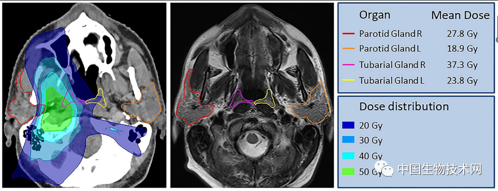 鼻咽|意外发现！鼻咽中一个被忽略几个世纪的“神秘组织”