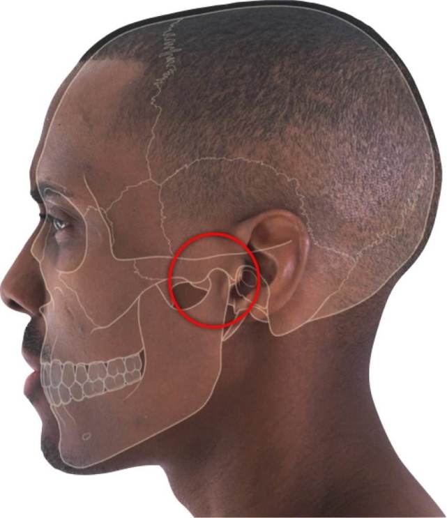颞部对称性位于头颅部两侧,上界内侧为颞浅动脉额支与颞嵴,下界为颧弓