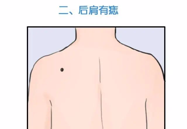 肩膀后有痣在咽喉上长痣的人,他们的一生都过得比较顺利,没有太多的