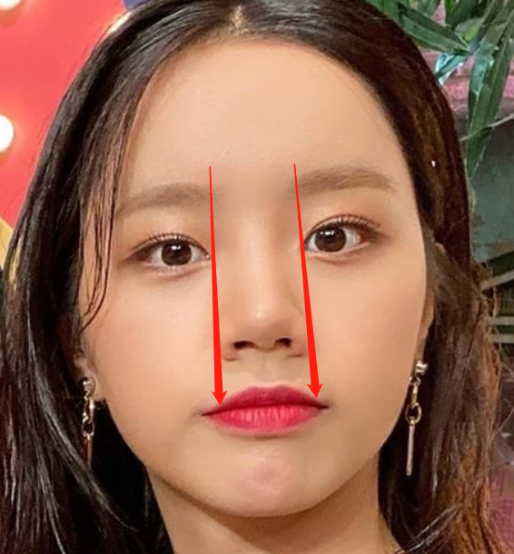 从照片判断,李惠利的鼻翼宽度和内眼角宽度持平,属于正常偏大的鼻子