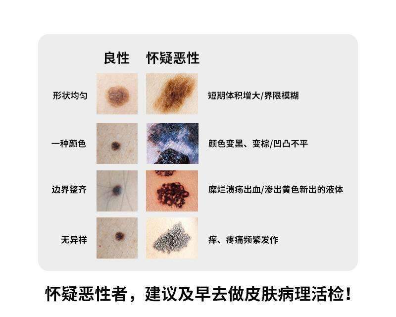 女孩校园卖花救患癌母亲,而自己患有恶性黑色素瘤,抗癌7年!