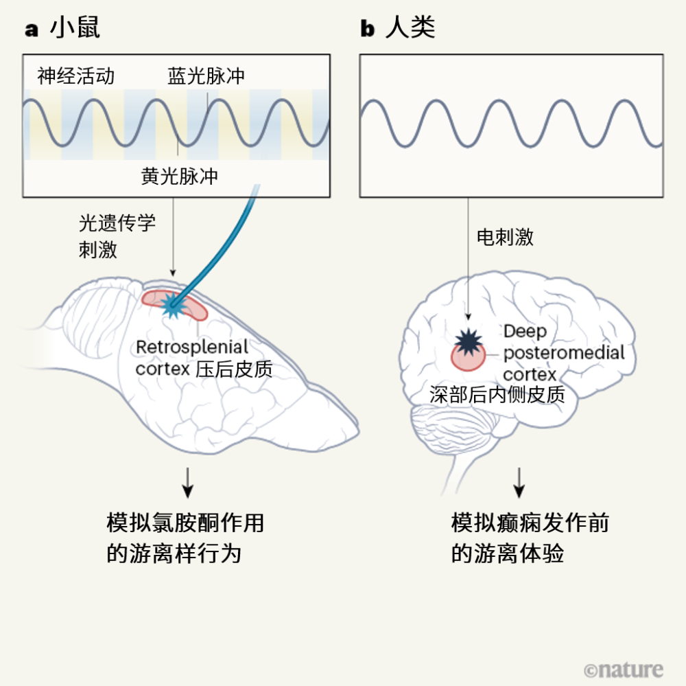 神经元|我们为什么会“灵魂出窍”？