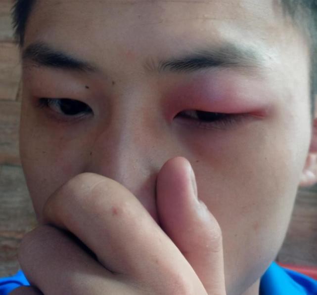 不管从哪个角度来讲,闷头觉都是一个不可取的睡眠方式.